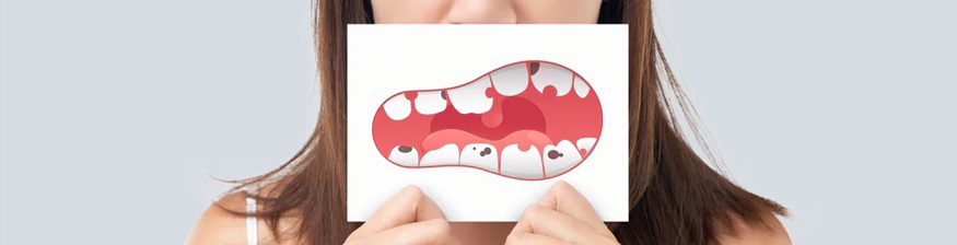 Can Probiotics Prevent Cavities & Gum Disease?